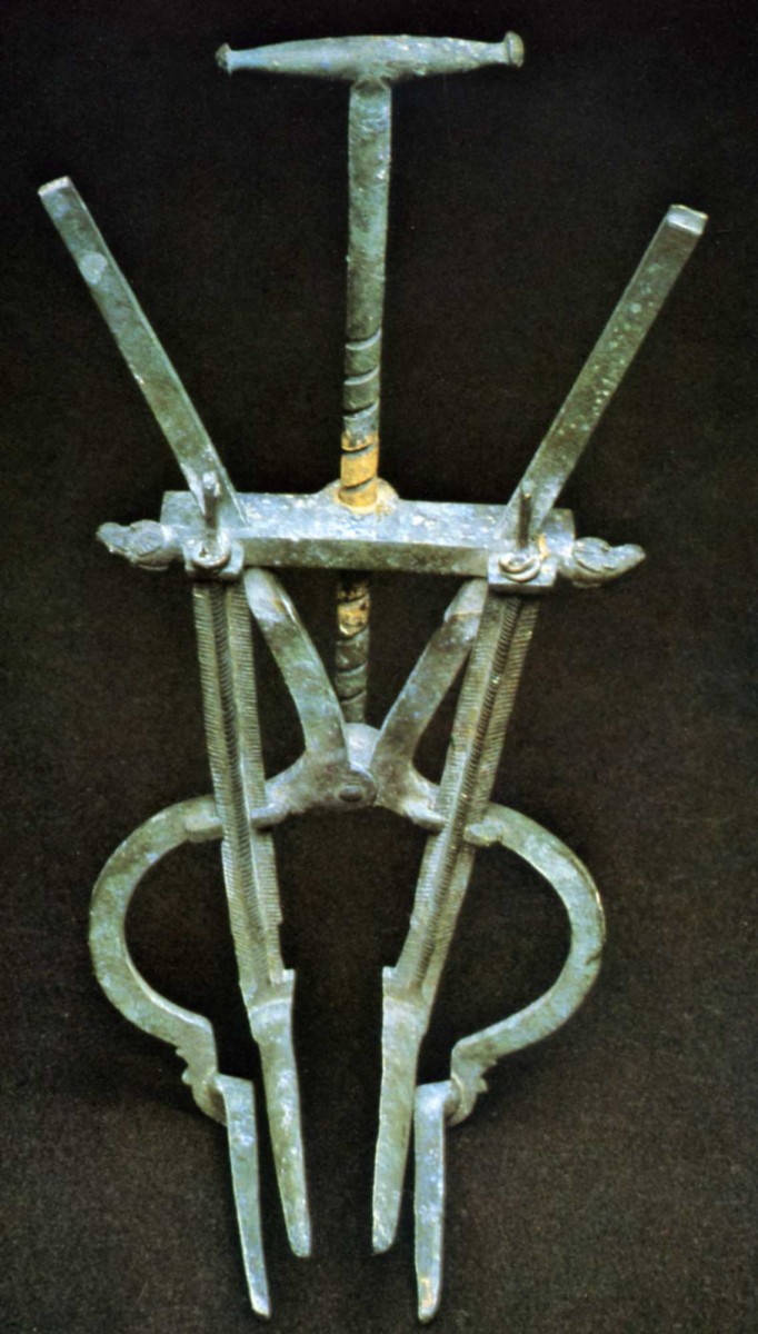 -79 speculum vaginal quadrivalve Pompei .jpg
